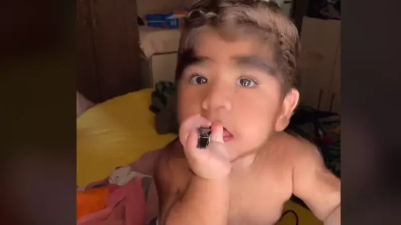 Bebê brasileiro viraliza no Tiktok por ter nascido com ‘barba’