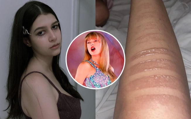 Fã sofre queimaduras de segundo grau no show cancelado de Taylor Swift Fã sofre queimaduras de segundo grau no show cancelado de Taylor Swift