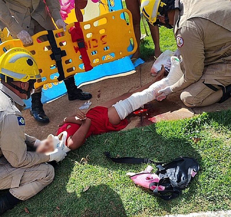 Acidente entre caminhão e moto deixa criança de 8 anos com fratura exposta em Nova Mutum