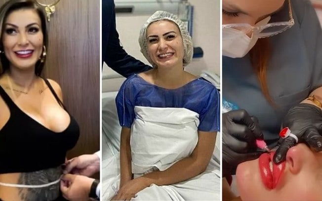 Andressa Urach passou por mais de 20 cirurgias: veja quais foram