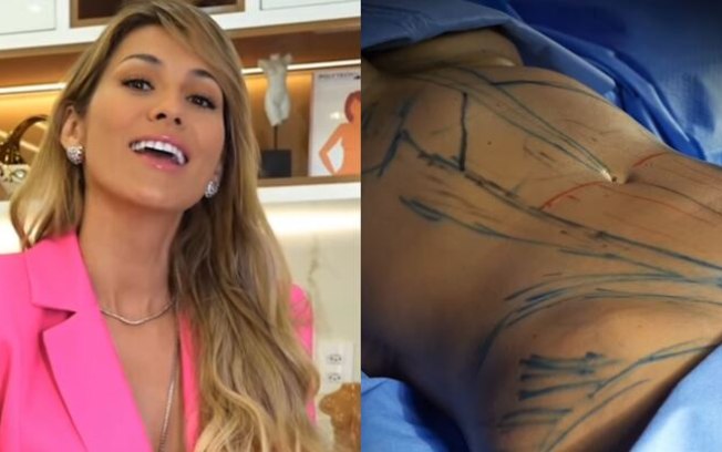 Lívia Andrade mostra resultado final de lipo LAD e comemora: ‘Feliz com a minha escolha’