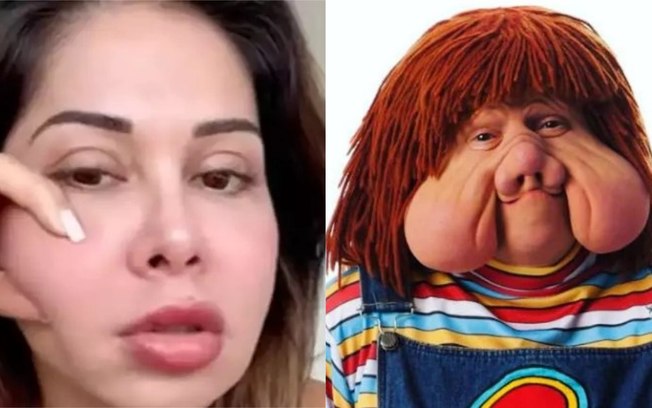 ‘Fico igual ao Fofão’: Maíra Cardi desabafa sobre inchaço e riscos do PMMA no rosto