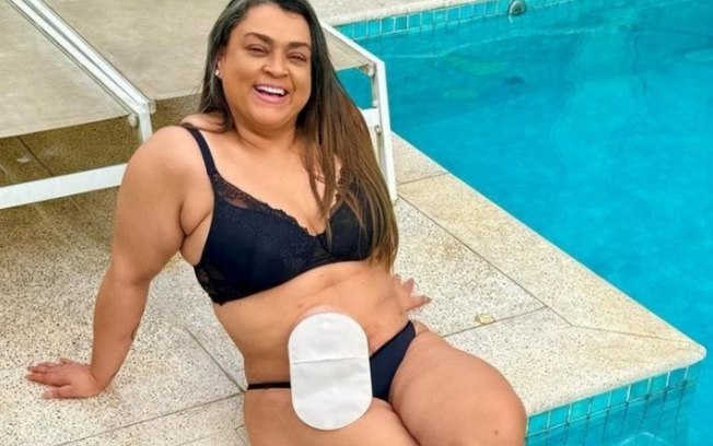 Entenda os desafios e cuidados da colostomia permanente