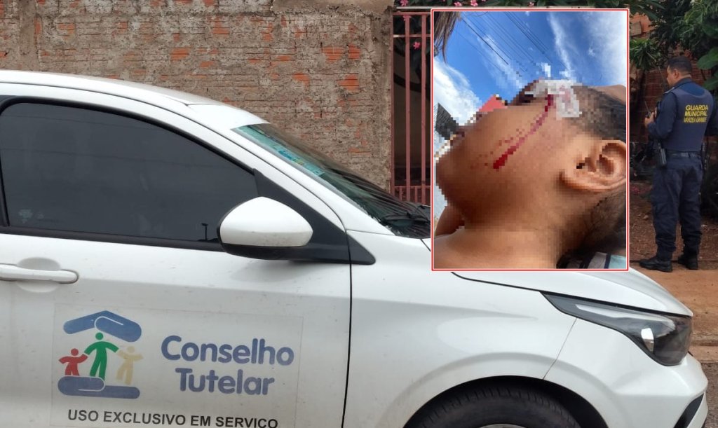 Mãe que agrediu filha de 3 anos com cabo de vassoura é solta após pagamento de fiança em MT Mãe que agrediu filha de 3 anos com cabo de vassoura é solta após pagamento de fiança em MT